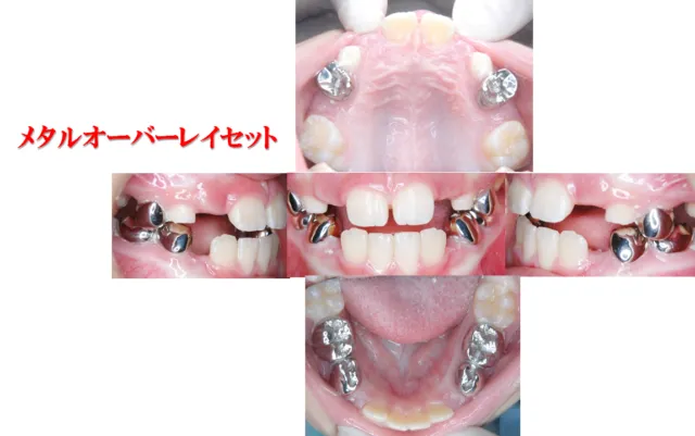 2×4テクニック/7歳/女性
