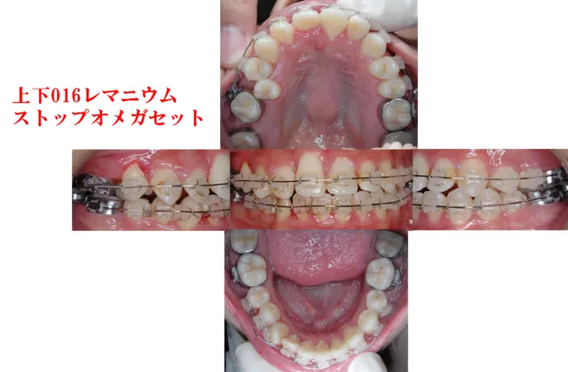 18歳/男性