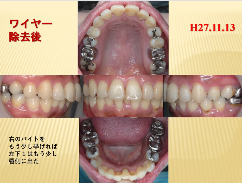 46歳/女性