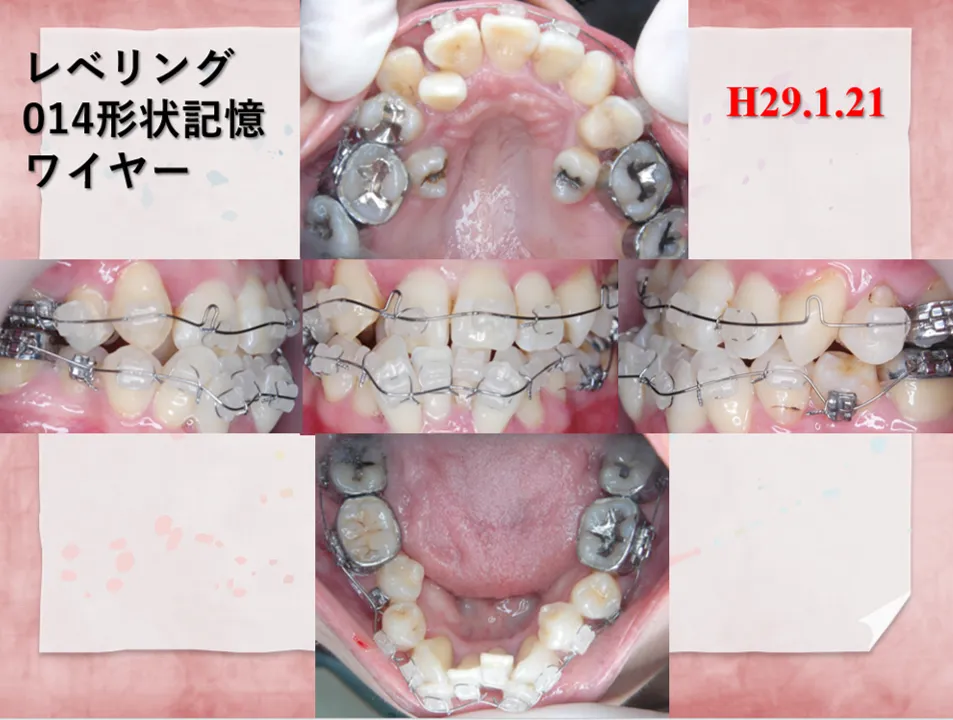 診療経過