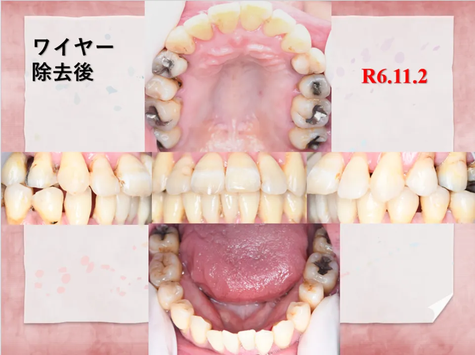 39歳/女性