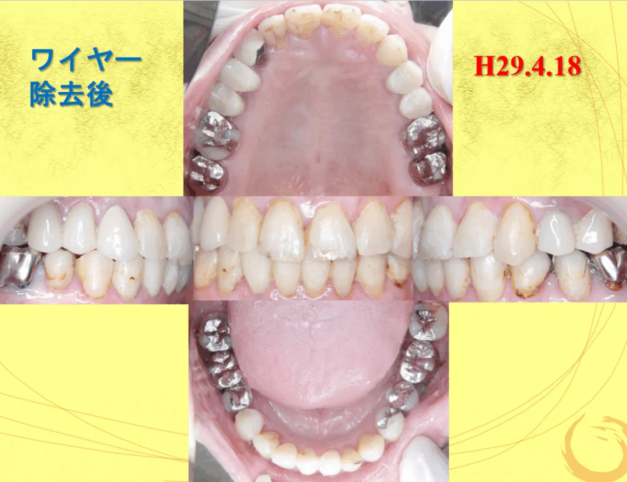55歳/女性