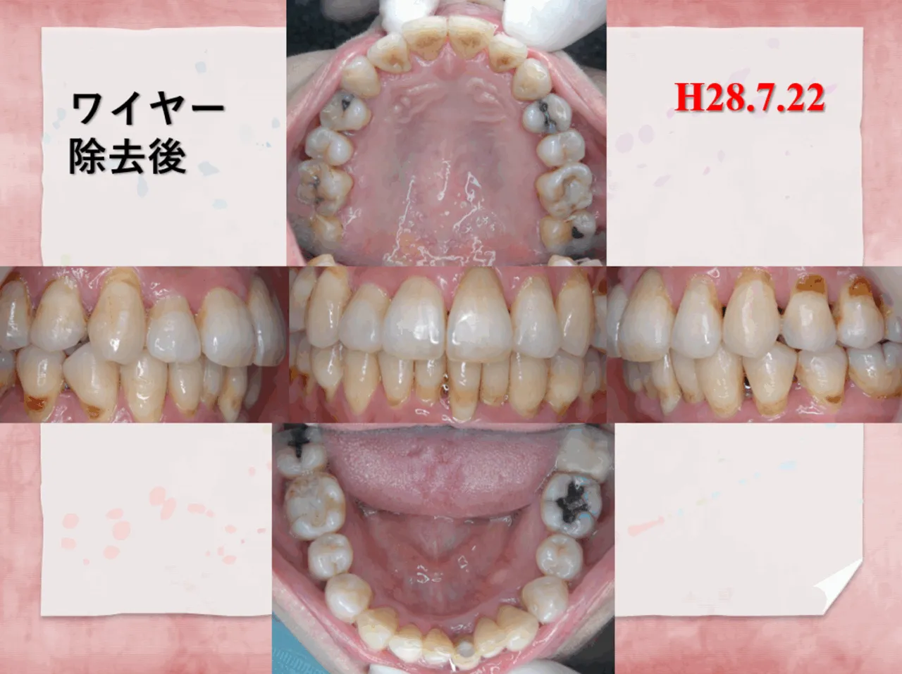 54歳/女性