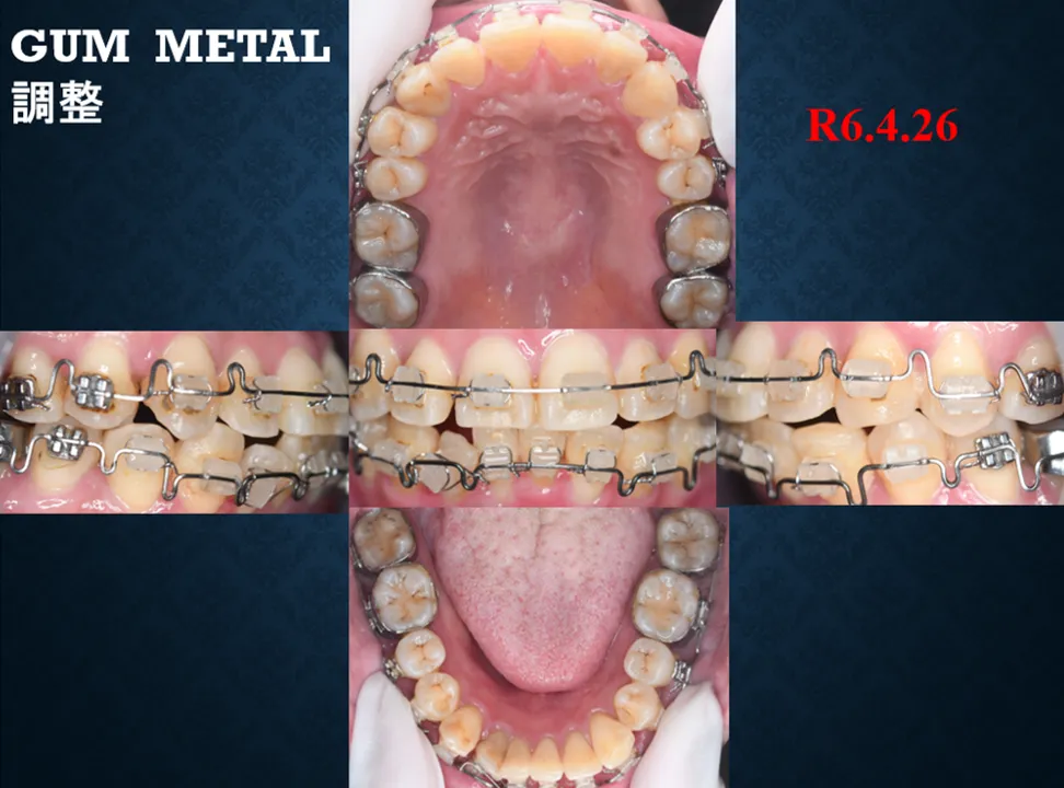 診療経過