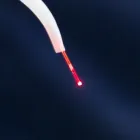 レーザー治療