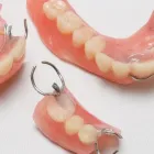 入れ歯